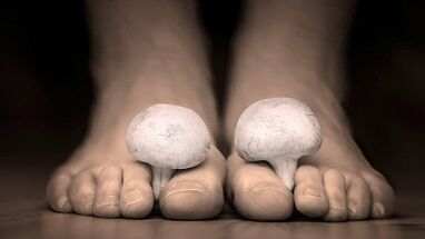 How to recognize the presence of fungus in the foot