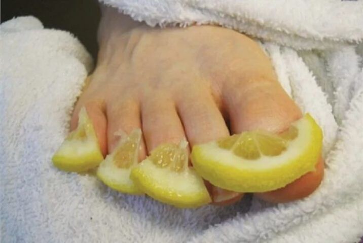 Compress from lemon drops - a folk remedy for toenail fungus